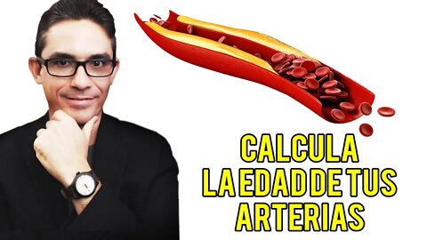 Calcule la edad de sus Arterias