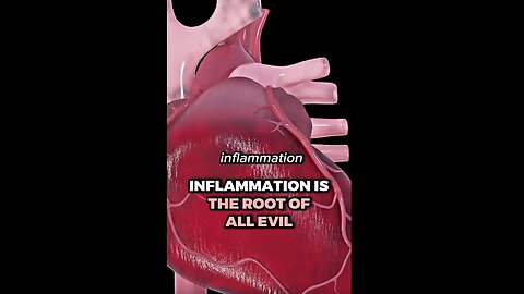 INFLAMMATION