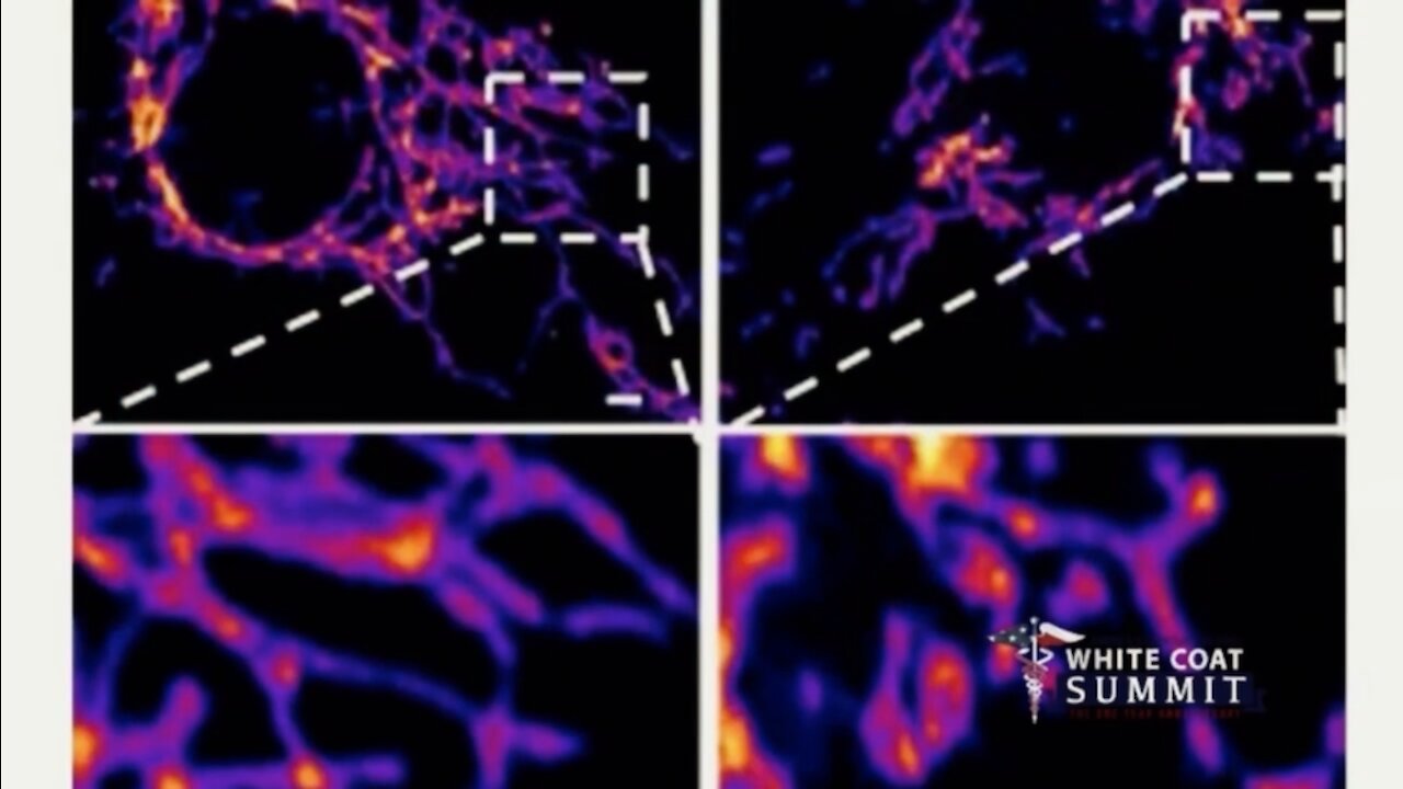 Pathologists Sounding The Alarm