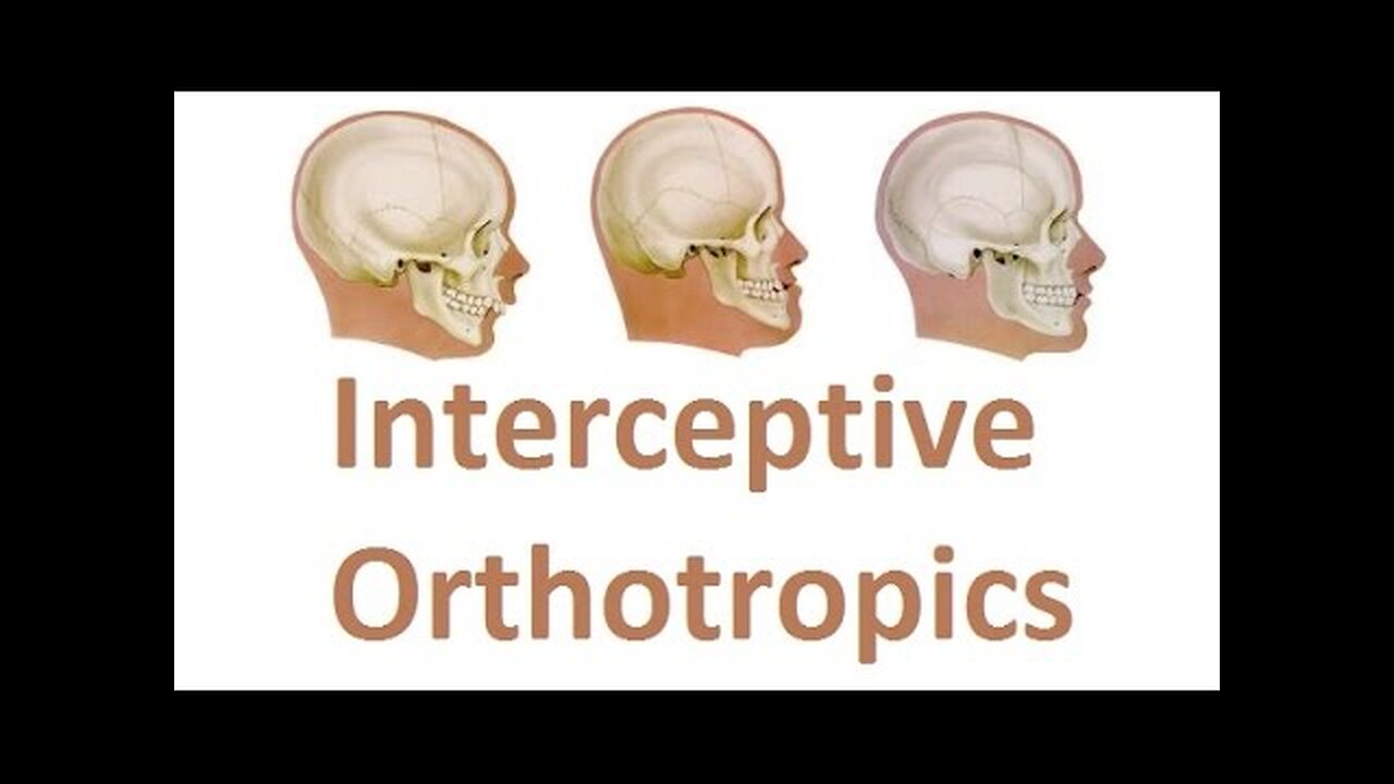 Correcting the Growth of Upper Jaw with Interceptive Orthotropics by Prof John Mew