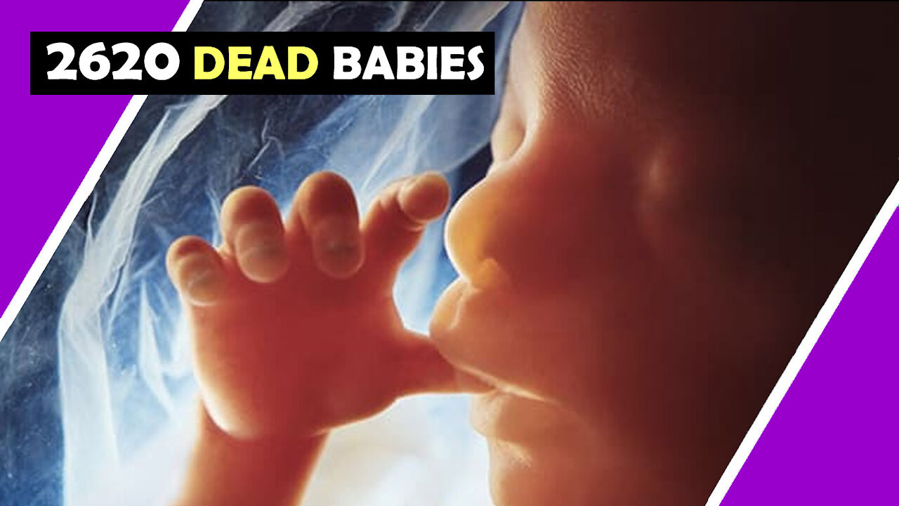 2620 DEAD BABIES / Hugo Talks #lockdown