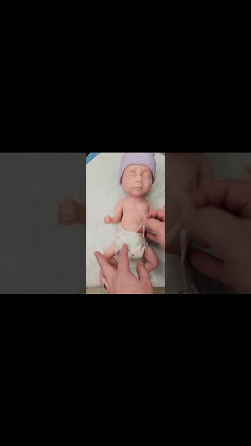 Surgery Time for Preemie Silicone Baby