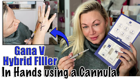 Gana V (Hybrid Filler) in my Hands using a Cannula from Celestapro.com| Code Jessica10 saves Money