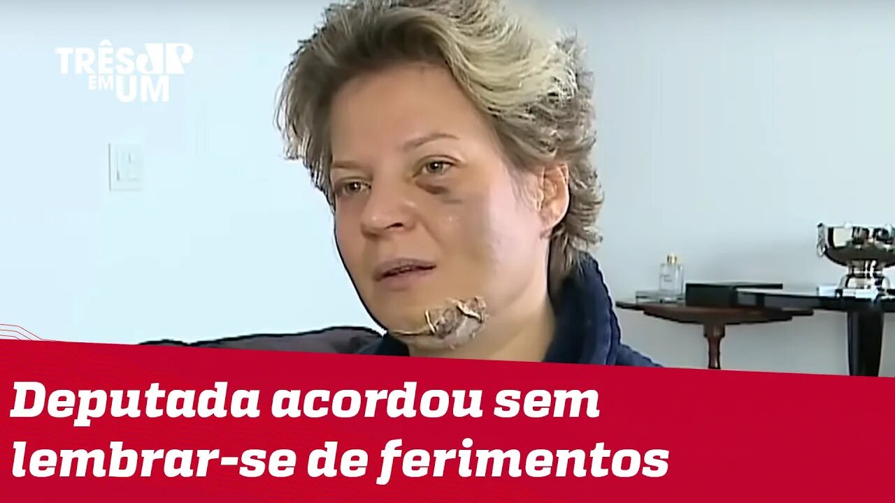 Joice Hasselmann apresenta lesões e diz ter sido vítima de atentado