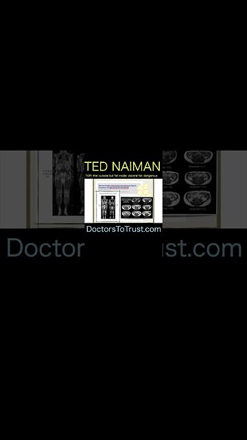 Ted Naiman B