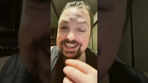 Theo Von Looks Like He’s on Meth 🤣