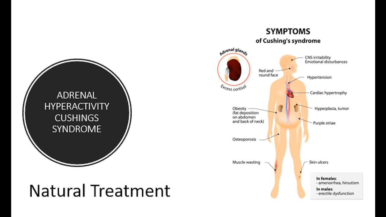 Adrenal Hyperactivity - Cushings Syndrome - Natural Treatment