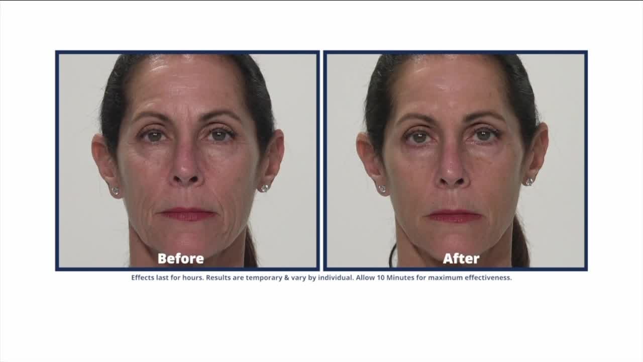 Plexaderm trial pack special deal