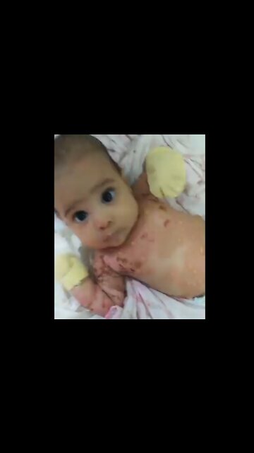 Mother was jabbed with Pfizer and breastfed her baby...