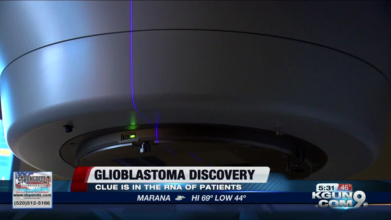 UA researchers find clue in fight against glioblastoma