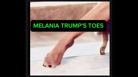 Melania’s Toes vs Diana’s Toes