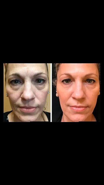 A FORMULA MAIS RECOMENDADA POR MEDICOS PARA PROLONGAR A BELEZA DA SUA PELE #shorts