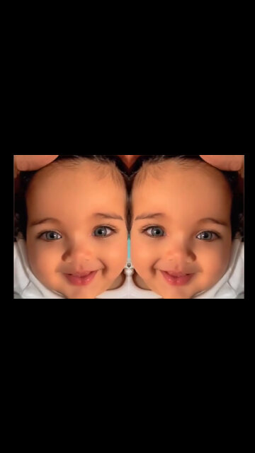 Beautiful Eyed Cute And Sweet Baby Smile