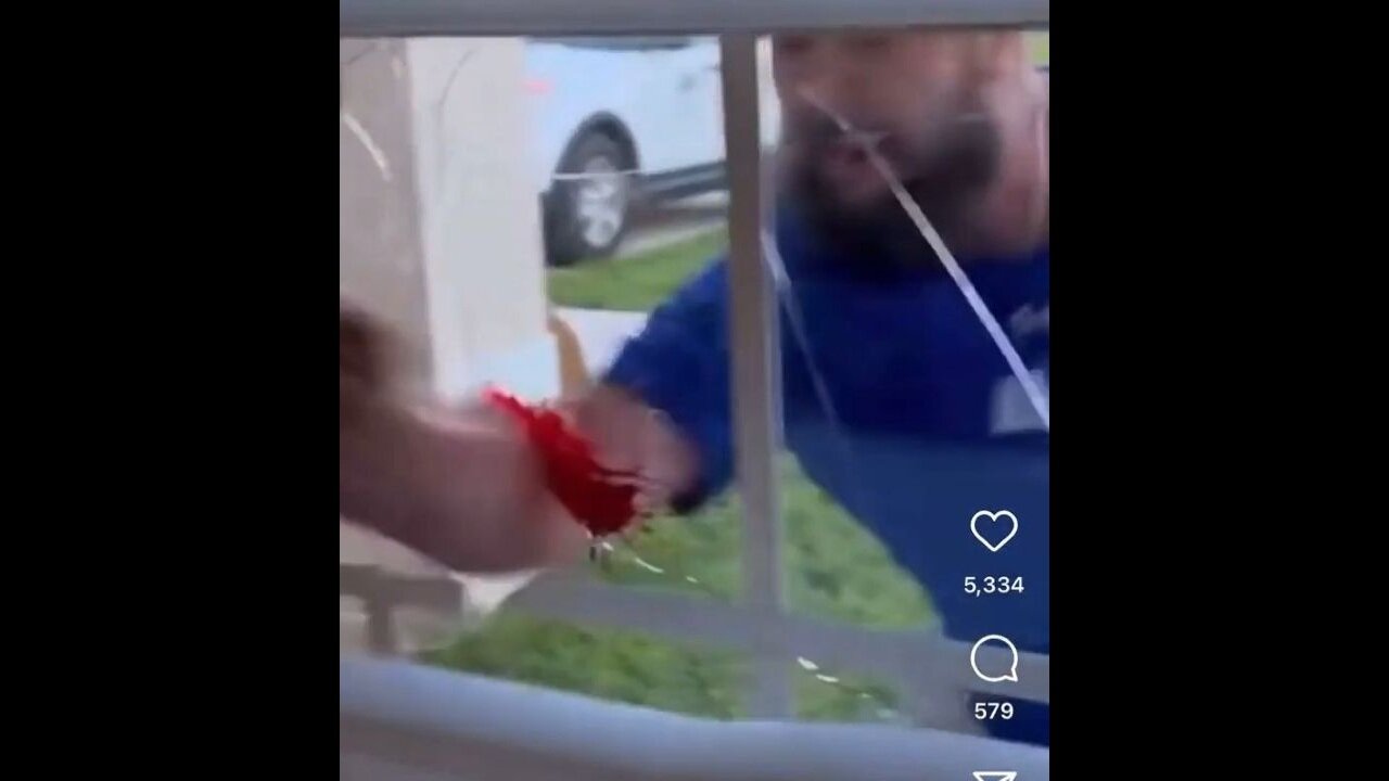 This Is Why You Should Never Punch A Window When You're Pissed