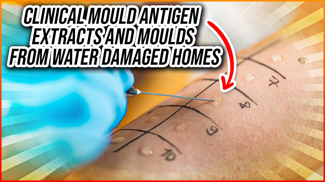 Clinical Mould Antigen Extracts and Moulds From Water-Damaged Homes