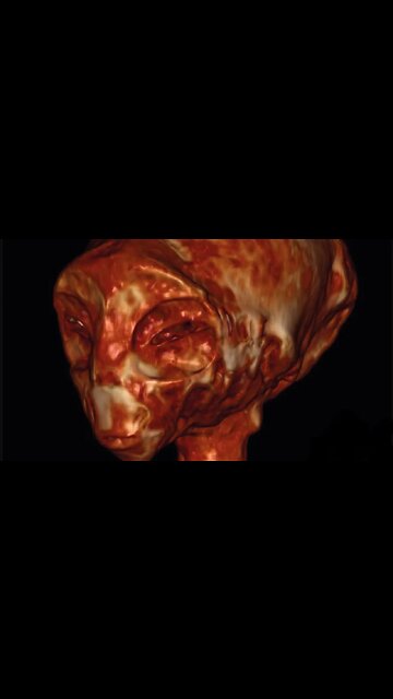 1000 year old ET Mummies of Nazca Peru revealed at the Mexican UFO Hearings (with English Subtitles)