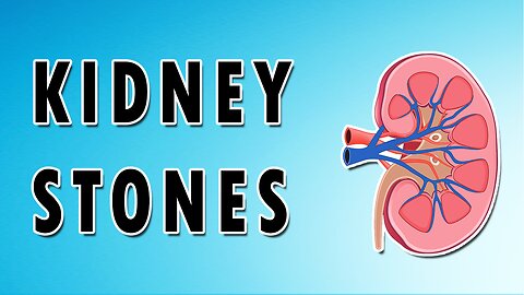 What cause kidney stones