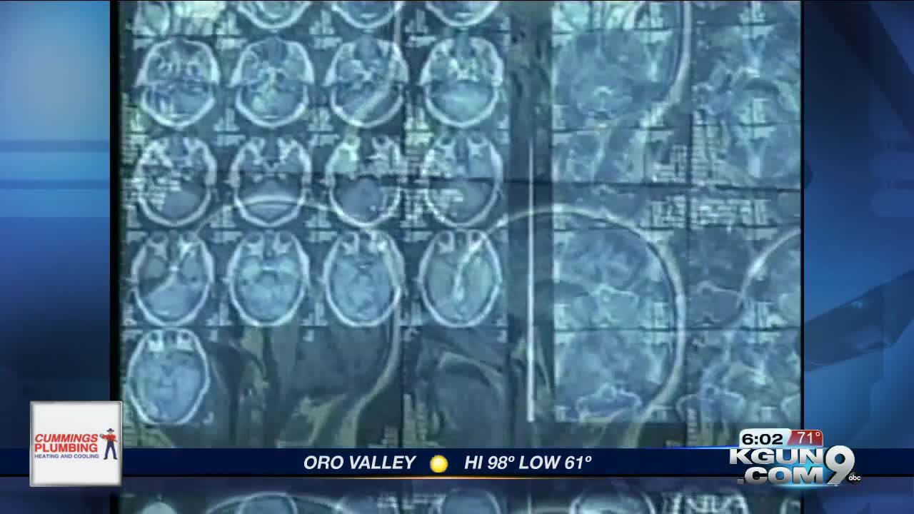 Health experts work to raise awareness of Alzheimer's