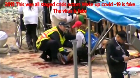 after watching this video and you still think Monkeypox The Ukraine war and is real your an idiot