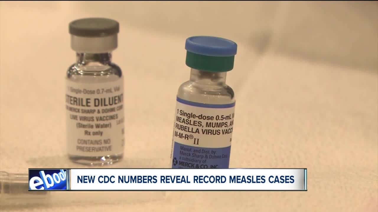 Measles outbreak is largest in US in 25 years, CDC says