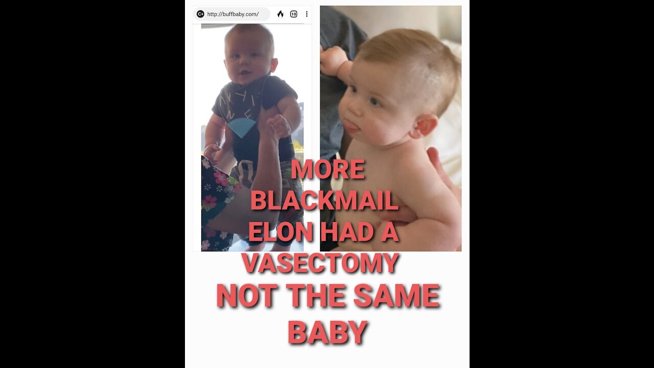ADDING DNA TESTING TO MY CLASS ACTION LAWSUIT ELON MUSK HAD A VASECTOMY YEARS AGO WAKE UP ❗🚨❗