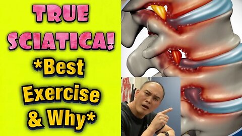 TRUE SCIATICA! *Best Exercise & Why* | Dr Wil & Dr K