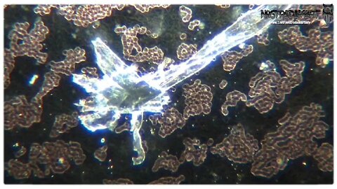 Reese Report (FR) - Hydrogels dans le vaccin COVID comme interface humaine programmable
