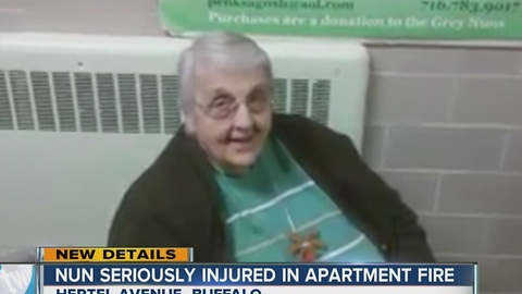 Sister Ruth in burn center