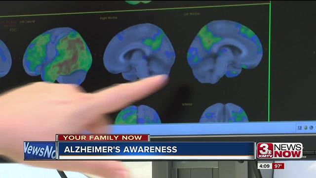 Benefit of early diagnosis for Alzheimer's disease