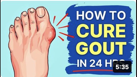 How to Heal Gout Naturally (Results in 24 hours!)