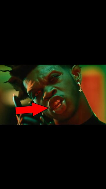 Transgender Thinks They're VAMPIRES!