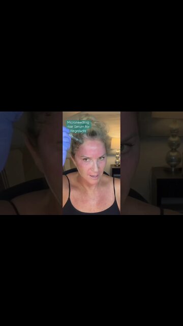 Microneedling Serum for Hair Regrowth!