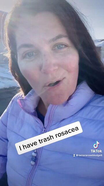 #rosacea #cure #skinissues