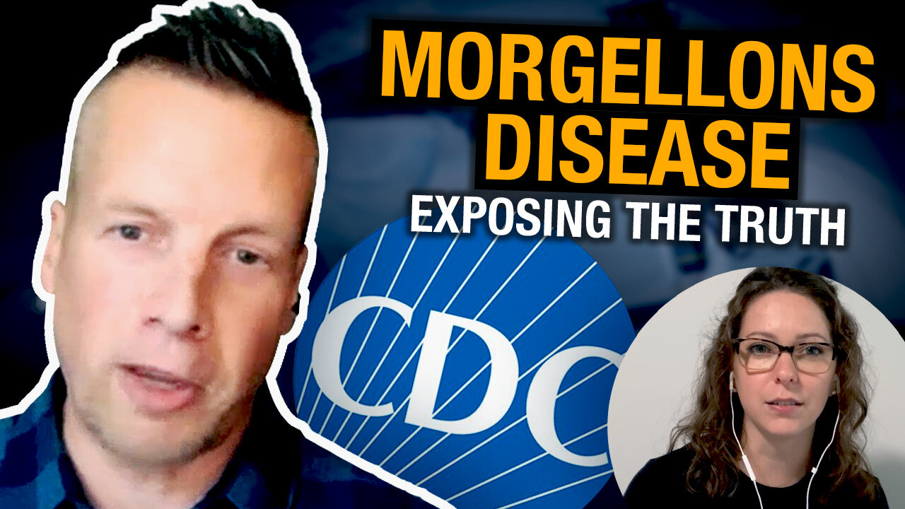 Strange skin affliction leaves B.C. man gaslit as delusional