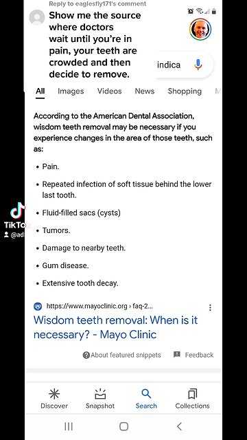 When to remove wisdom teeth