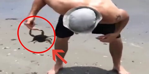 This crab bit the hands and feet of this boy