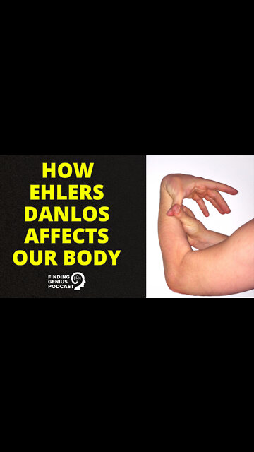 How Ehlers Danlos Affects Our Body #shorts