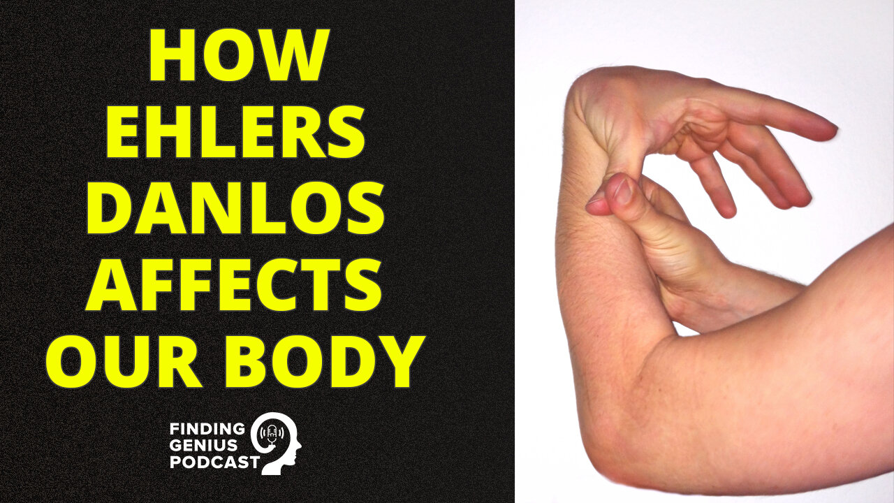 How Ehlers Danlos Affects Our Body #shorts