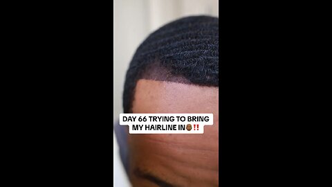 DAY 66 TRYING TO BRING MY HAIRLINE IN👨🏾‍🦲‼️