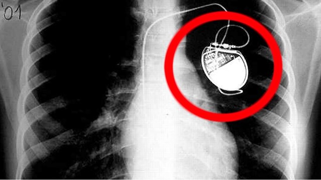 10 Accidental Medical Discoveries