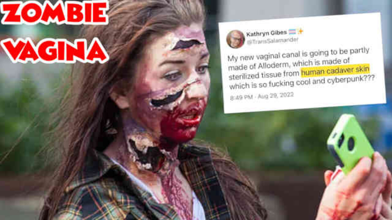 Dude Brags About Getting Vagina Made Out Of Cadaver Skin Surgery