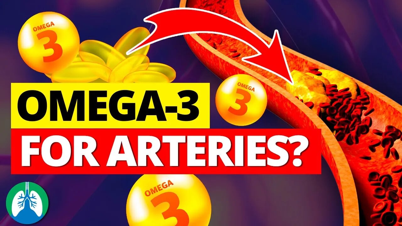 ❣️ How to Use Omega-3 to Clean Your Arteries (Lower Heart Attack Risk)