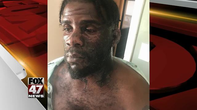 Man recovering from chemical attack