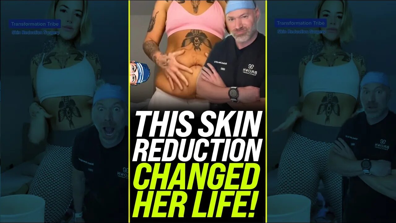 Skin Reduction Changed Her Life 😍 #shorts