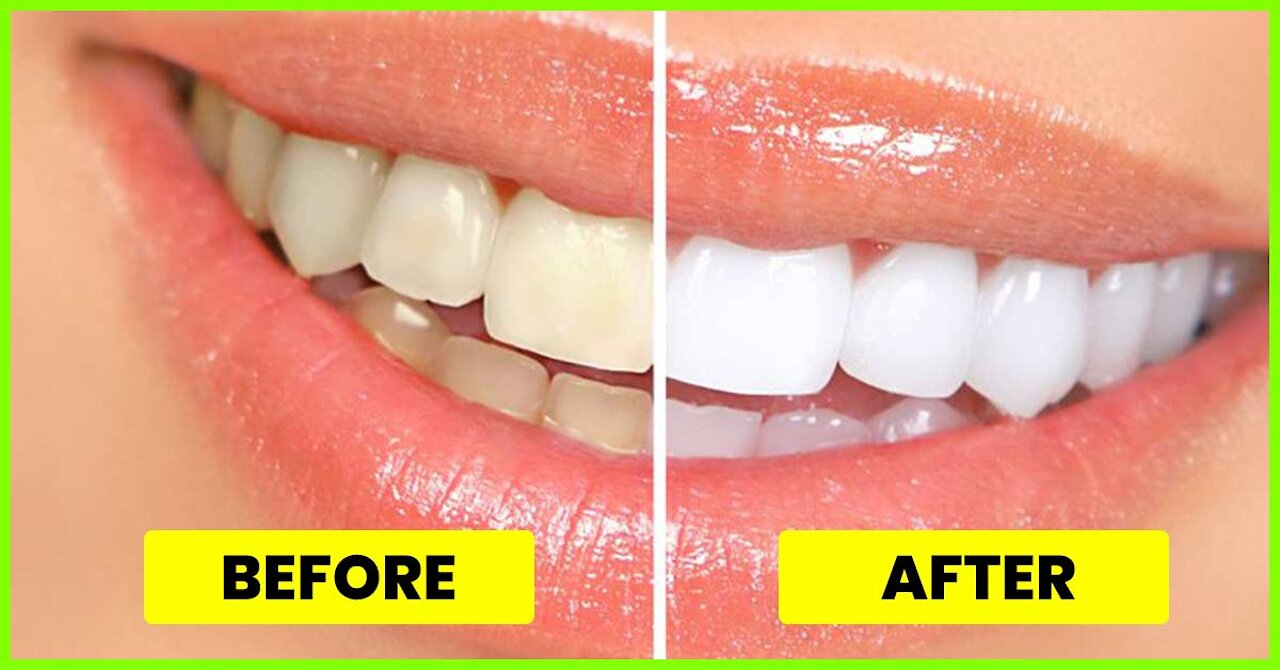 HOW TO WHITEN TEETH IN 3 MINUTES AT HOME, GET RID OF YELLOW TEETH