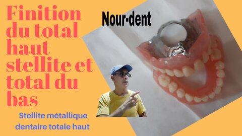 Stellite métallique dentaire totale haut et bas