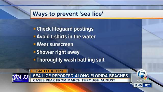 Advice on preventing sea lice