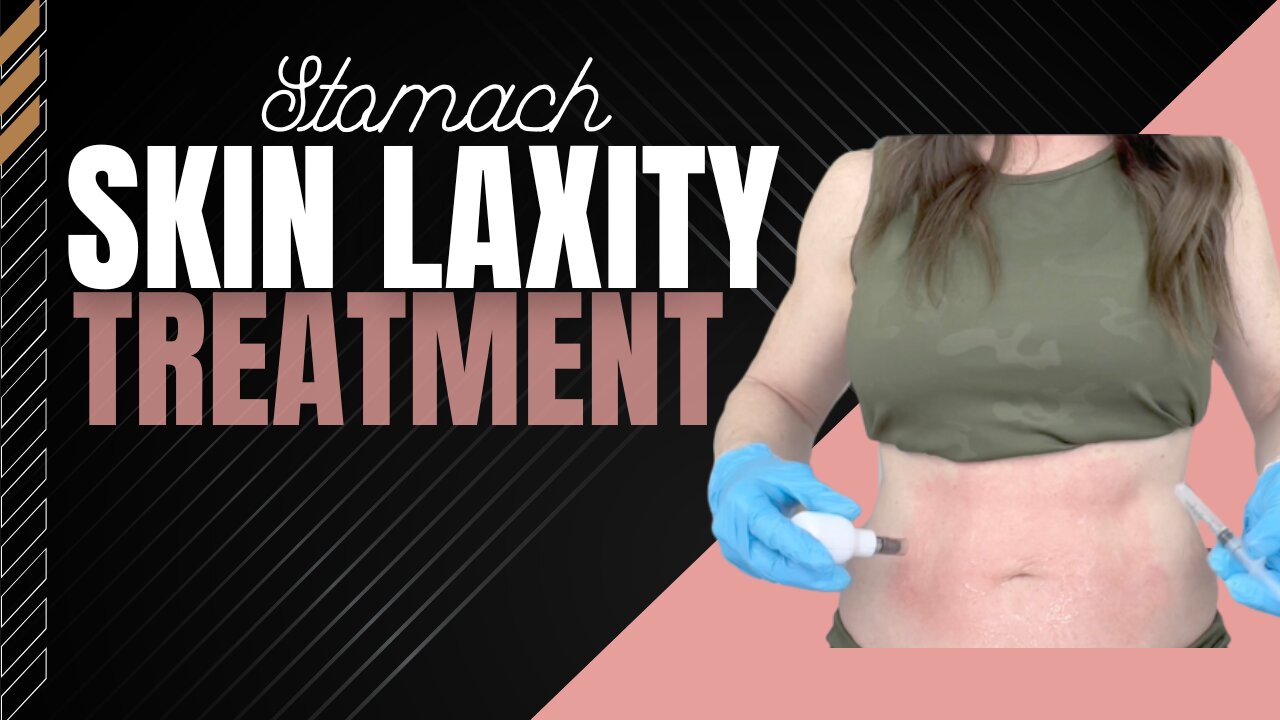 LOOSE STOMACH SKIN TIGHTENING GUIDE | Derminator 2 Microneedling