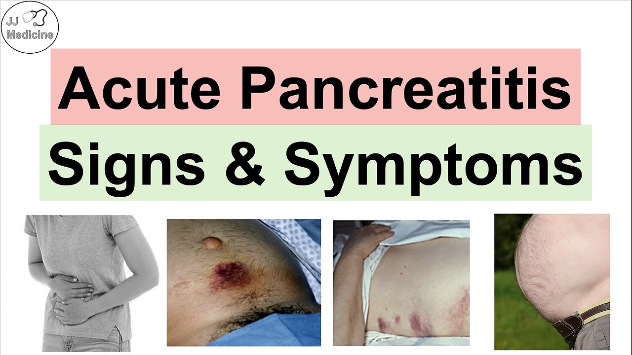 Acute Pancreatitis Signs & Symptoms (& Why They Occur)