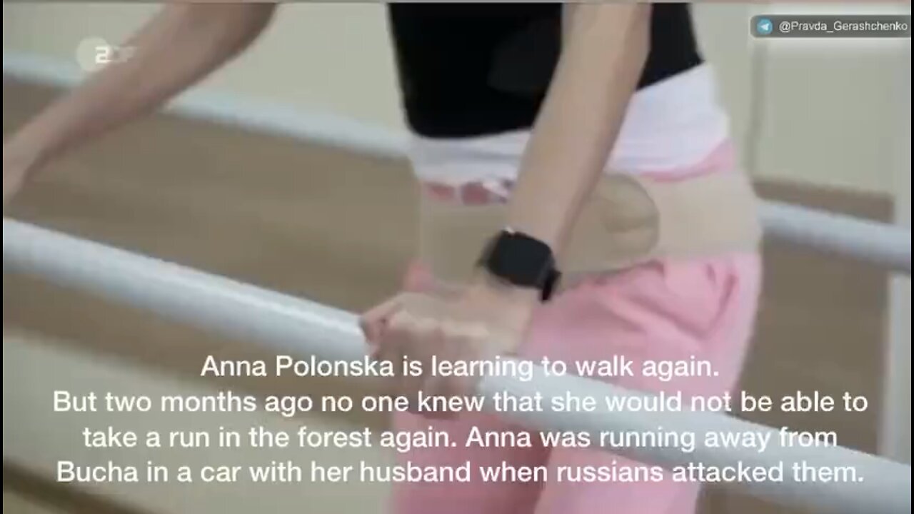 Anna lost her husband and a pregnancy trying to escape #Bucha. She now is learning to walk again.